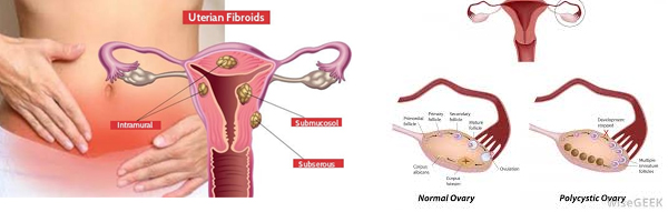 Gynaecological Checkup